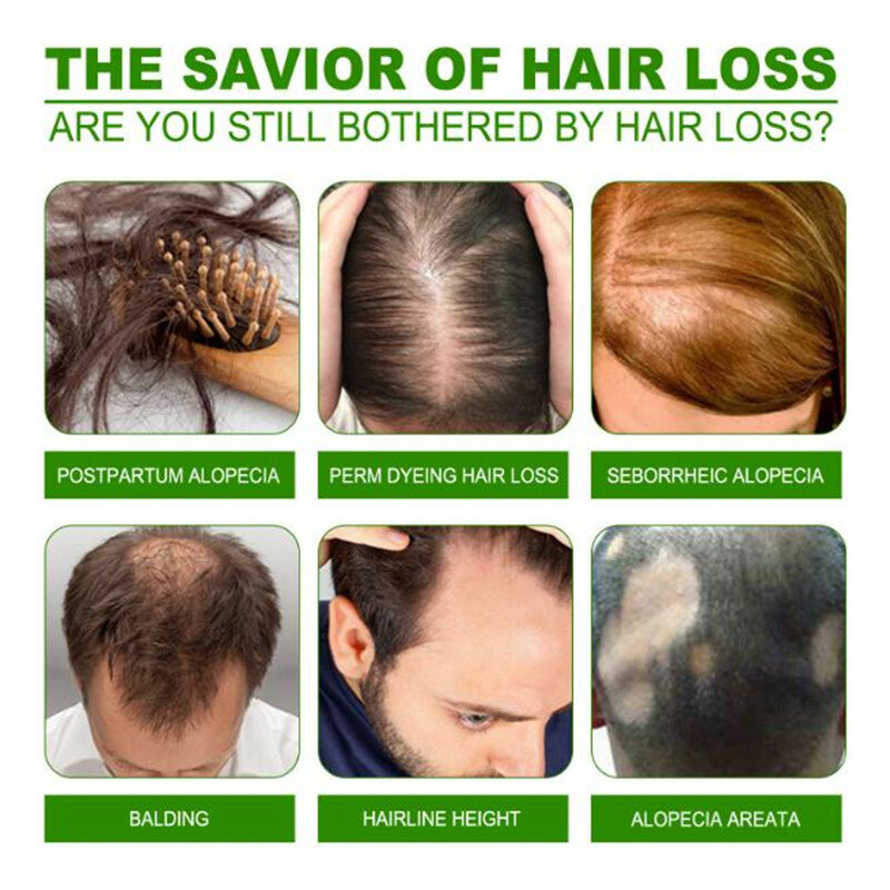 120ml Neue Haar Lotion für Wurzel Haar, Bart und Koteletten Länger Pflanzliche 100% Original Behandlung Nährstoffe MSDS
