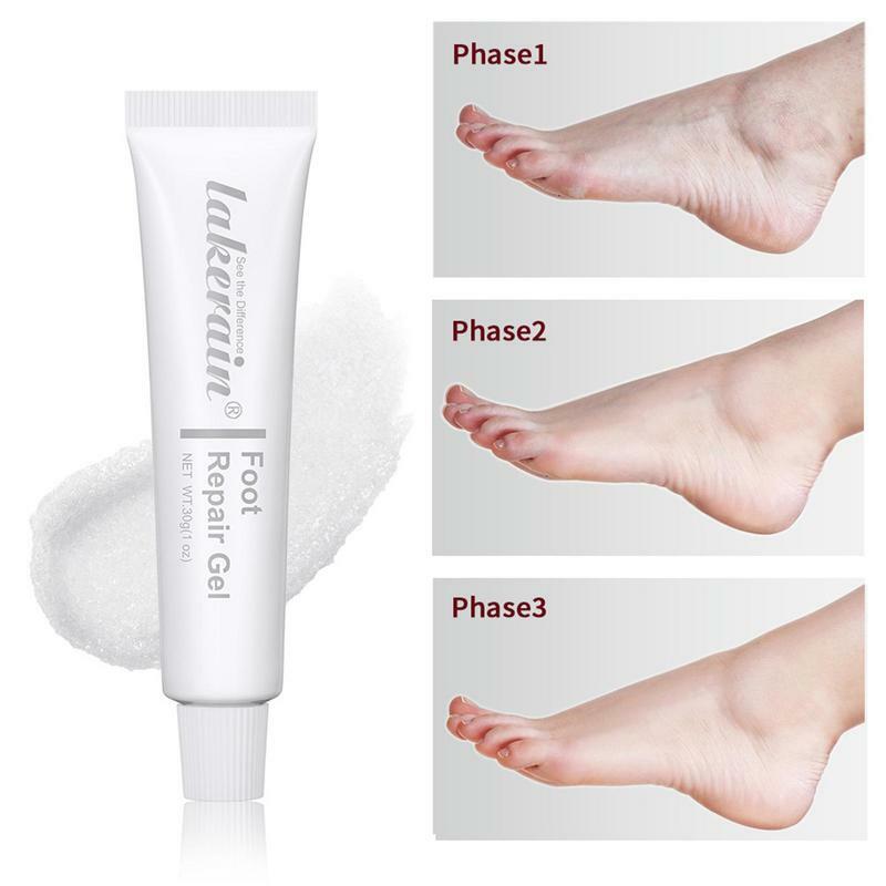 Mascarilla para el cuidado de los pies, crema reparadora de manos agrietadas, eliminación de piel muerta, tratamiento para la piel, exfoliación