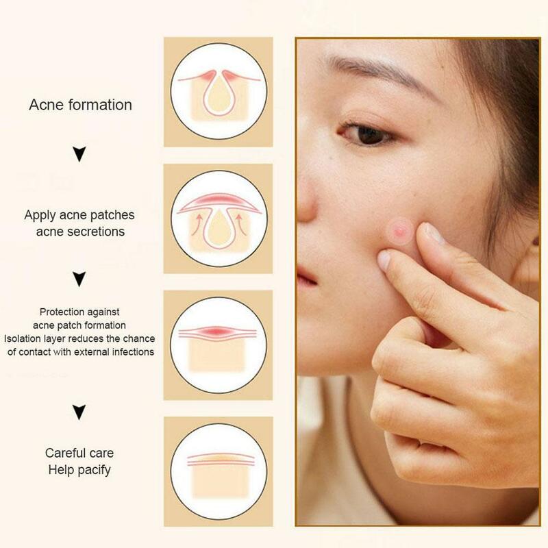 Black Pink Heart Shaped Acne Patch Skin Care Sticker correttore Facial Spot Beauty Makeup Tool