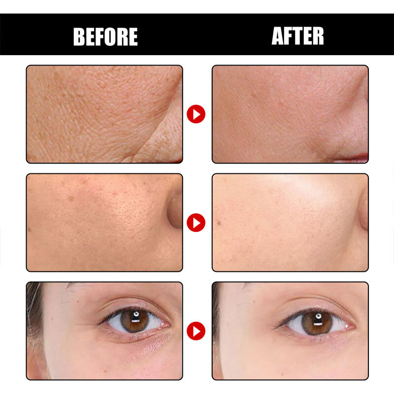 Collagen Wrinkle Remover เซรั่ม Anti Aging Whitening Moisturizing Fade Fine เส้นจุดด่างดำ Brightening เครื่องสำอางเกาหลี