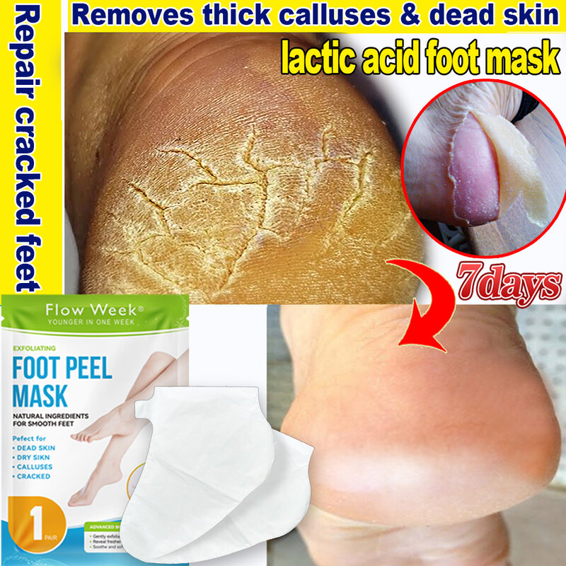 Exfoliating Foot Mask Foot Peel Mask Peeling Dead Skin Remover Calluses Anti Cracked heels Moisturizing Pedicure Socks Foot Care