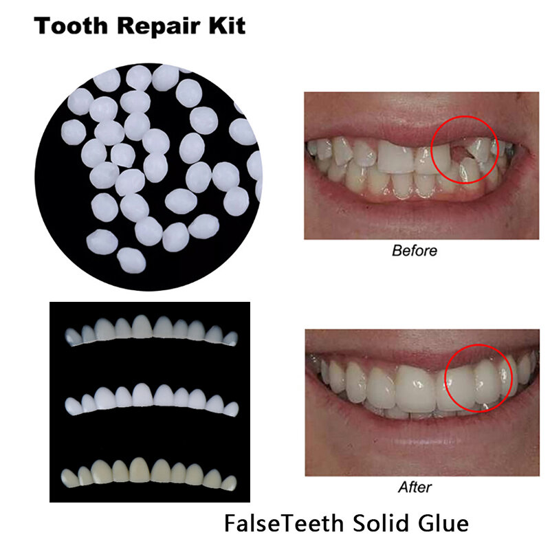 طقم إصلاح مؤقت لاصق أسنان ، غراء صلب falseteth ، فجوات أسنان ، مجموعة واحدة