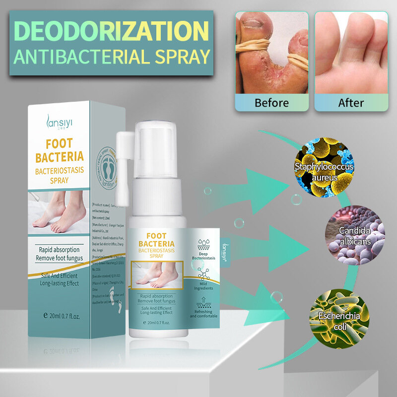 Spray antibacteriano para pies, alivia Beriberi, mejora eficazmente el pelado de ampollas, repara el cuidado de los pies, desodorante de larga duración, 20ml
