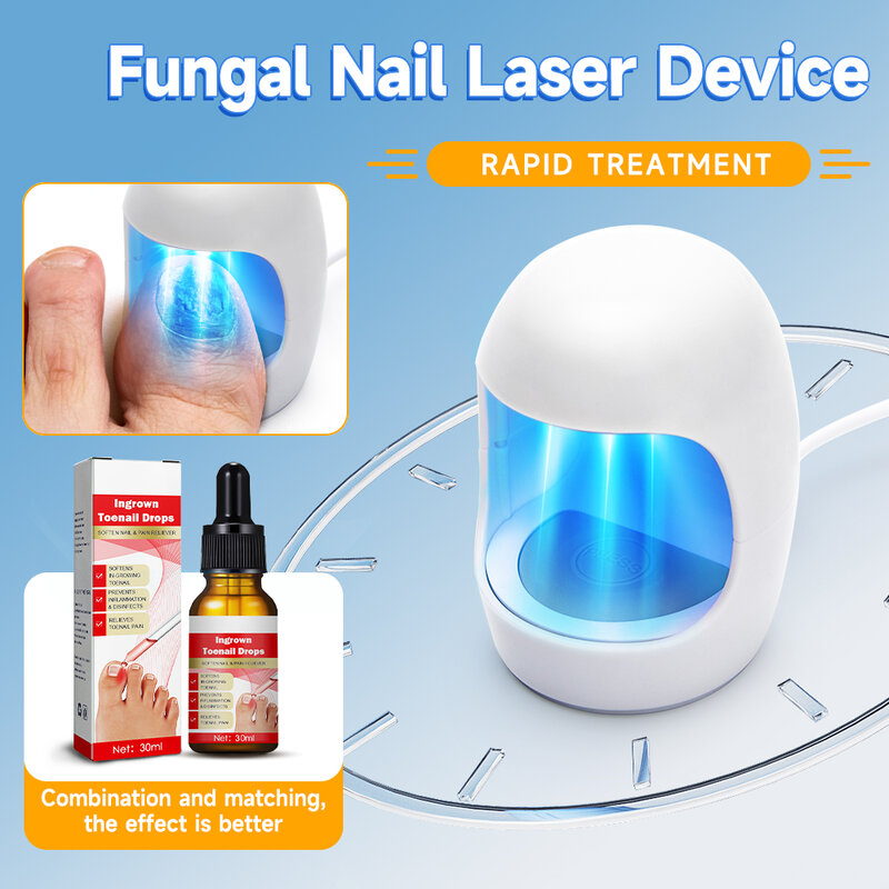 Dispositivo di trattamento Laser per funghi alle unghie trattamento fungino essenza per la cura dei piedi Anti infezione paronichia onicomicosi unghia incarnita