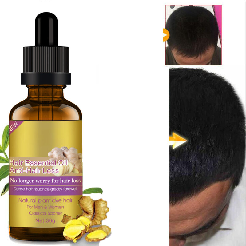 Óleo essencial da planta do gengibre, reparo do cabelo, proteção da furcação, cuidado do crescimento do cabelo, perda do Anti-cabelo, frete grátis