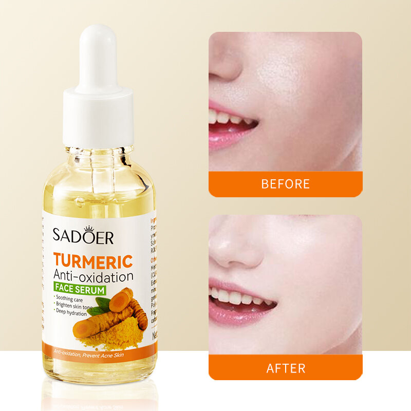 Turmeric Freckle Whitening Serum Anti-oxidant Nourishing Moisturizing Repair Skin Brighten Fade Dark Spot Essence Face Skin Care