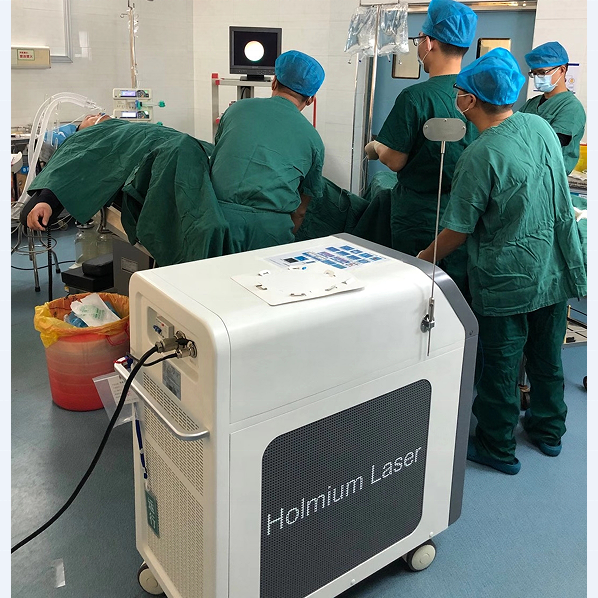 Láser de fibra de thulium, equipo de Urología Ho YAG de 40, 80 y 90W, Láser de Holmium para tratamiento de piedras de ureter y litotricia