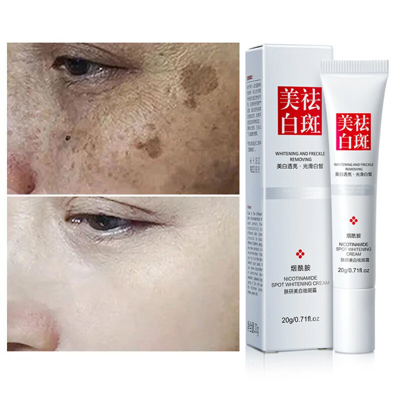 Effektive Weiß creme aufhellen Gesicht für Gesichts flecken entfernen dunkle Flecken Melasma Anti-Pigmentierung verbessern Mattheit Hautpflege creme