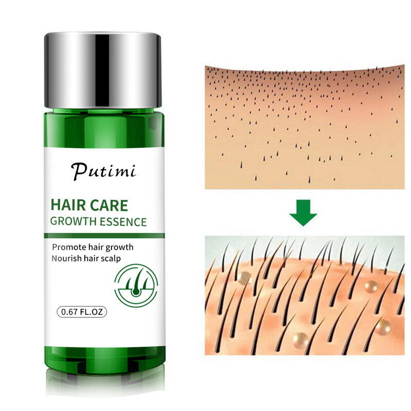 Сыворотка для роста волос Продукты для быстрого роста волос предотвращает выпадение волос Восстановление поврежденных волос натуральный Уход за волосами для мужчин и женщин 30 мл TSLM1