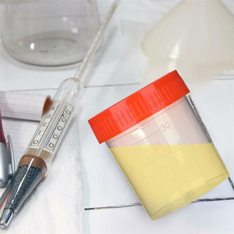 50pcs 40ml Urine Collection Sample Bottle Container Specimen Cup Sample Collection Cup Laboratory Cylinder Color Send Random