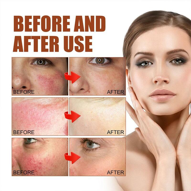 30 مللي الوردية علاج مصل حمامي إصلاح جوهر مهدئا وترطيب الجلد إصلاح الوجه مصل العناية بالبشرة