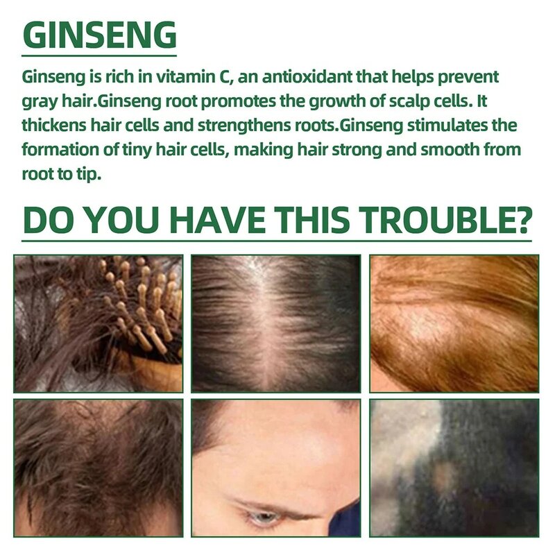 OUHOE Ginseng  Hair Growth Serum Oil With Biotin Essential Liquid Strengthen Hair Root Nourishes Hair Repairing Hair Growth