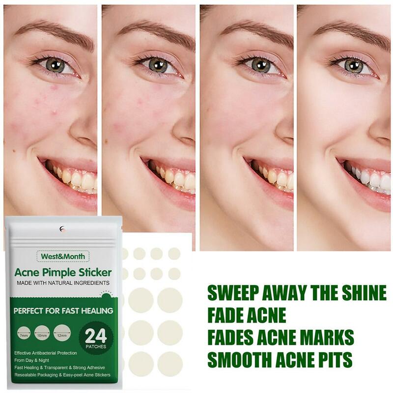 Akne Pickel Patch Aufkleber Akne Behandlung Pickel Entferner Werkzeug Haut fleck Gesichts fehler Pflege Maske Patch