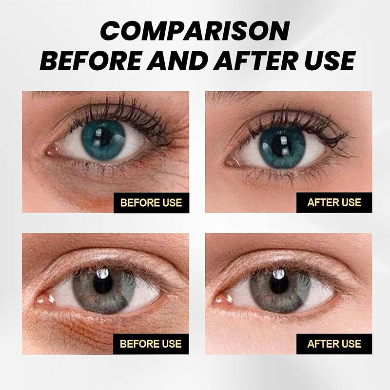 Anti-rugas Eye Cream, desvanecer-se círculos escuros, remove rugas oculares, levantamento reafirmante, hidratante cuidado