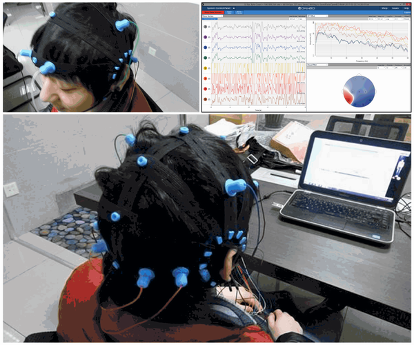 Nouvelle casquette de cerveau, toutes les électrodes sèches, compatible avec la série OpenBCI Ultracortex _ Mark