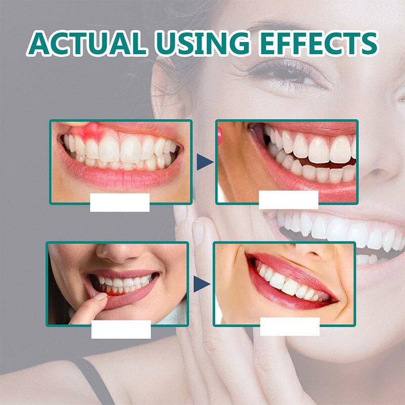 30ml Gum Care Products Liquid Gum Repair Gum Regrowth Natural Oral Care Drops Gum Restore Oral Gum Care Liquid For Oral Care
