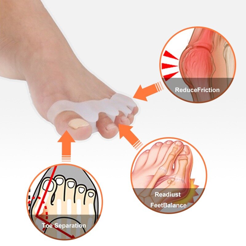2 шт. гелевые сепараторы для пальцев ног восстанавливают пальцы до начальной формы корректоры для пальцев ног разделители для перекрытия и БЛИСТЕРОВ