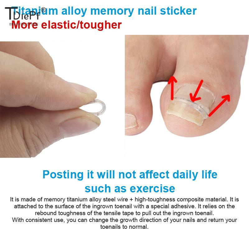 1set 25/30Pc 13-19mm Nail Correction Stickers Ingrown Toenail Corrector Patches Paronychia Treatment Recover Care Pedicure Tools
