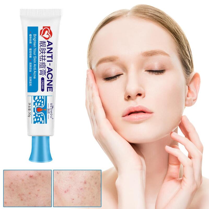 25g Acne Removal Cream Anti-Acne Gel Effective Treatment Scar Control Pimple Care Spot Blackhead Oil Skin Moisturizer Q3R8