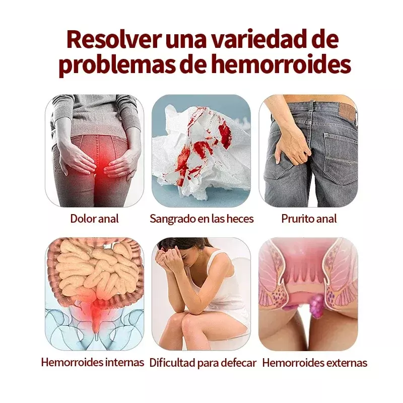 Emorroidi trattamento crema mucchi sollievo dal dolore Intemal rimozione delle emorroidi esterne anale Fissure Hua Tuo medicina spagnola