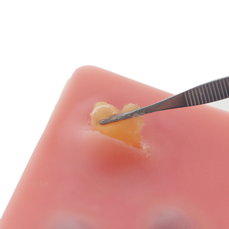 Módulo de sutura de escisión del quiste cutáneo de la piel, habilidades quirúrgicas, ejercicios de simulación para entrenamiento de estudiantes de medicina, enseñanza