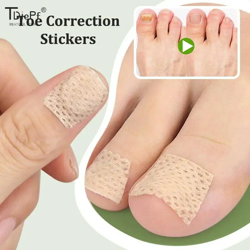 สติ้กเกอร์แก้ไขนิ้วเท้าคุดขนาด2/6/12ชิ้นอุปกรณ์ตกแต่งเล็บแพทช์เท้าดูแลรักษาเท้าเครื่องมือรักษาเล็บเท้า