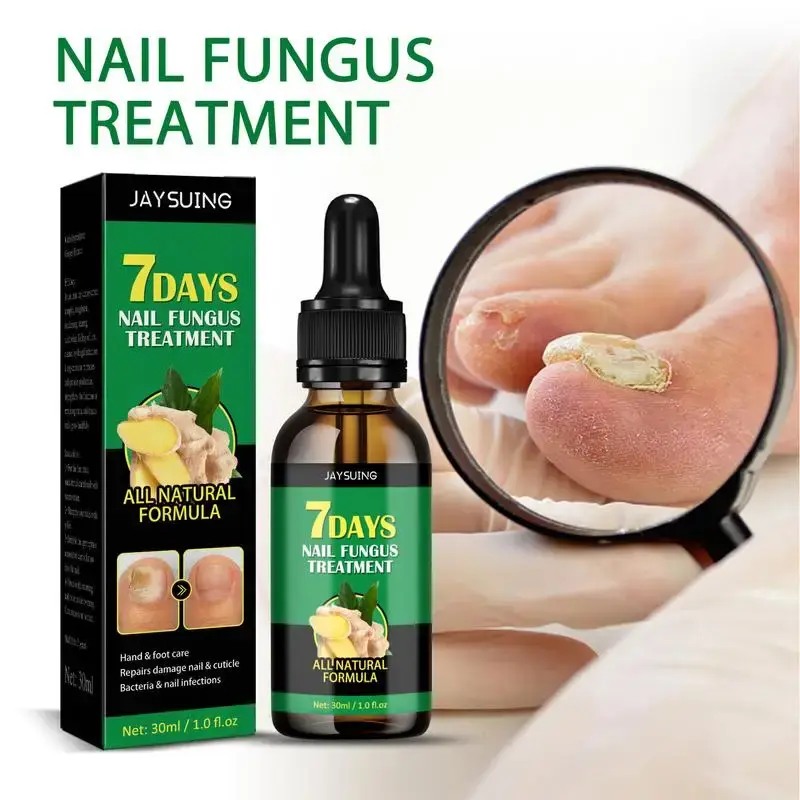 Tratamiento de uñas fungicida, aceite esencial, hongo de uñas, dispositivo láser para reparación de uñas de los pies, tratamiento de uñas, onicomicosis, 30ml