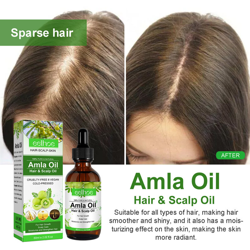 Amla-aceite Original para el crecimiento del cabello, esencia India anticaída, tratamiento del cuero cabelludo, reparación del cabello dañado, 60ml