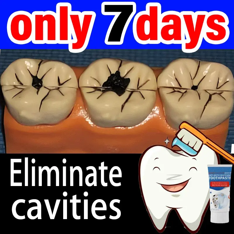 Elimina las cavidades, blanqueamiento dental efectivo, cálculo, placa, Periodontitis