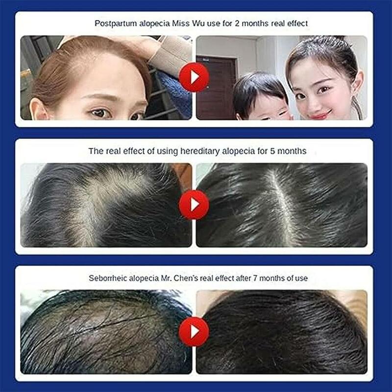 Anti Hair Loss Shampoo com extrato de ervas, Flower Sent Snow Oil Control, Remoção de caspa, Soft Hair Care, Haircare, 240ml