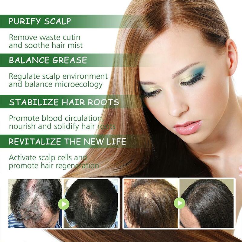 Aceite Esencial de Romero para el cuidado del cabello, accesorio que nutre las raíces del cabello, repara bifurcaciones y daños en el cabello, alivia el cabello, cuidado del cabello, 2/4X