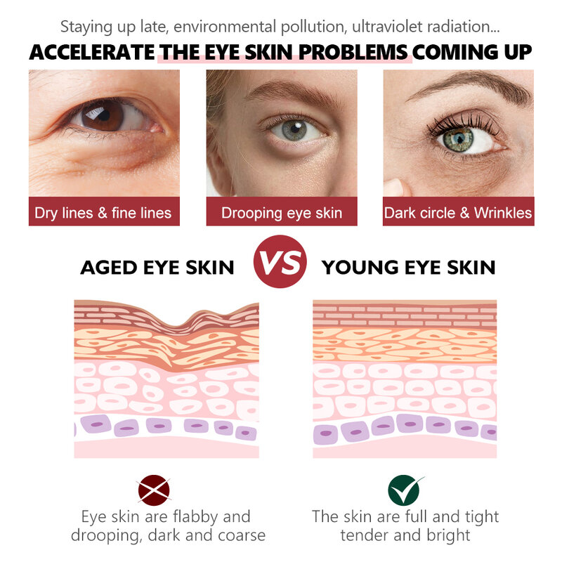 Remove Dark Circles Retinol Eye Serum Improve Eye Bags Lifting Firming Essence Fade Fine Lines Moisturizing Brighten Skin Care