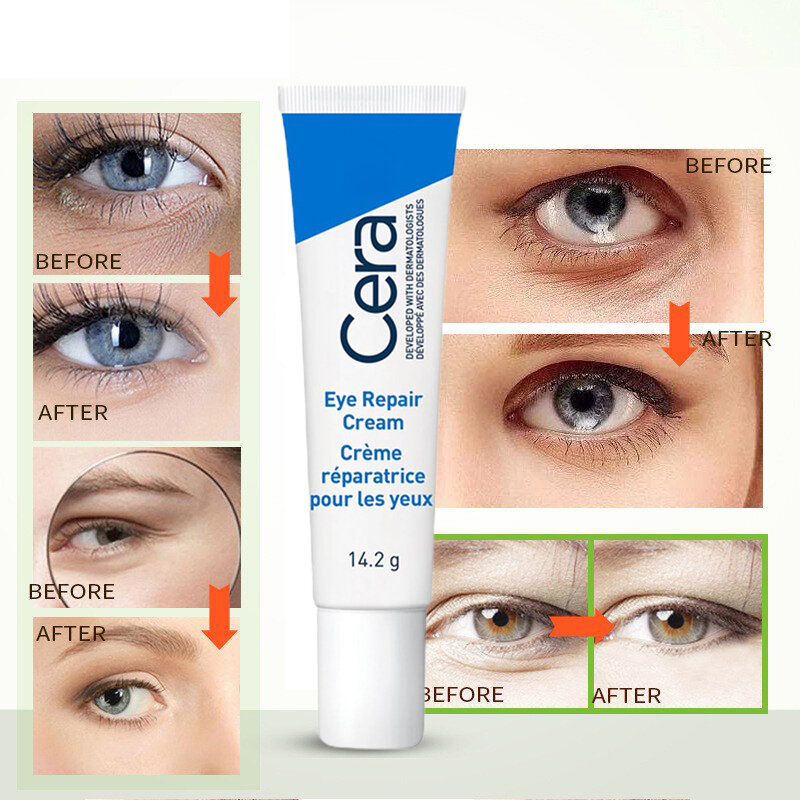 Retinol Anti-rugas Eye Cream, removedor de círculos escuros, anti-inchaço Eye Bags, Fade Fine Lines, Nutritivo, Eye Care, Beleza Saúde