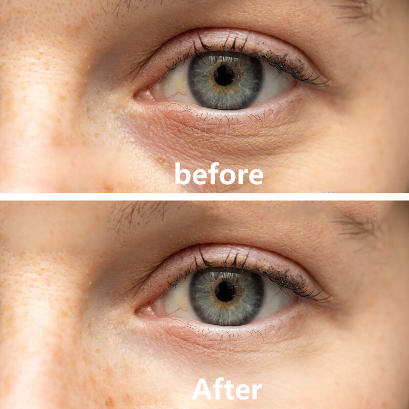 1 ~ 10PCS Eye Skin Care Crystal Collagen Gold Eye patch Anti-Aging occhiaie maschera di bellezza per l'acne cosmetici coreani idratare il Gel
