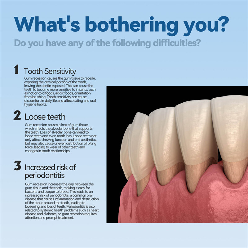 Jaysuing Gum Care Gel zur Tiefen reinigung von Zahn flecken, Zahnstein, Schwellungen und Schmerzen