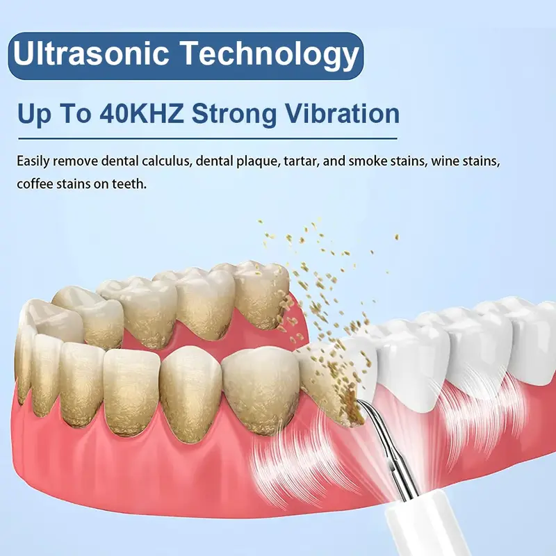 Ultrasonic Dental Scaler, tártaro Eliminador, Placa Calculus Remover, Escalando Remoção, Tooth Cleaner