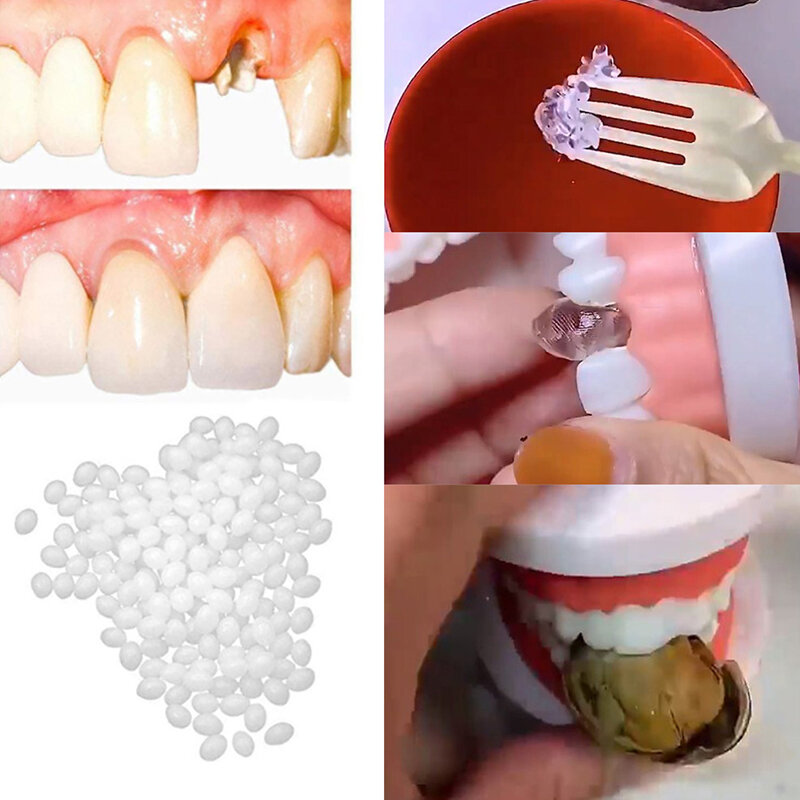 Alat kecantikan gigi palsu, 10g/15g/25g sementara gigi dan lubang gigi palsu lem padat gigi tiruan perekat pemutih gigi