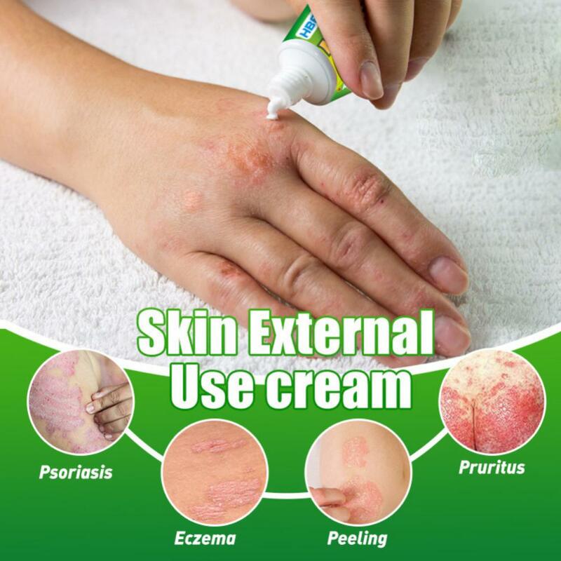 Cuidado suave e seguro com coceira na pele, alívio e remédio para irritação da pele, uso externo, dermatologista-recomendado