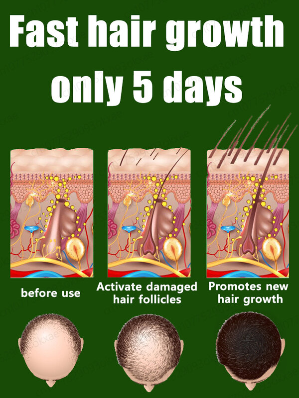 Anti-Alopezie schnelles Haarwuchs öl Ingwer ätherisches Serum