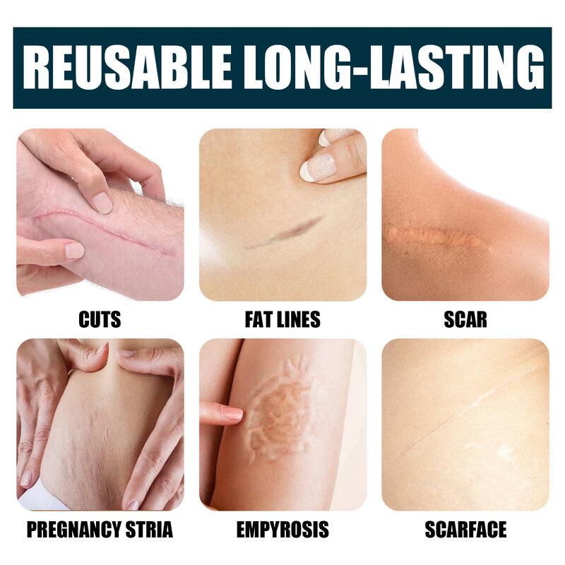 Crema para eliminar cicatrices y acné, Gel alisador para el cuidado de la piel corporal, promueve la regeneración celular, certificado GMP, 50g