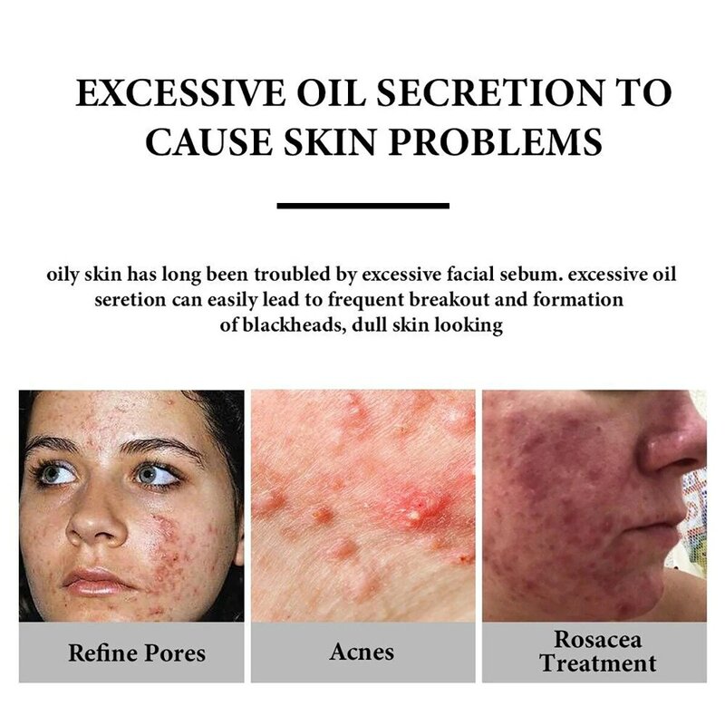 Trstay vitamina c soro para rosto hidratante ilumina o reparo da pele suave essência facial soro cuidados com a pele produtos
