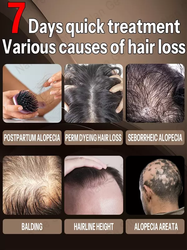 Aceite esencial para el crecimiento rápido del cabello Corrige la calvicie y la caída del cabello
