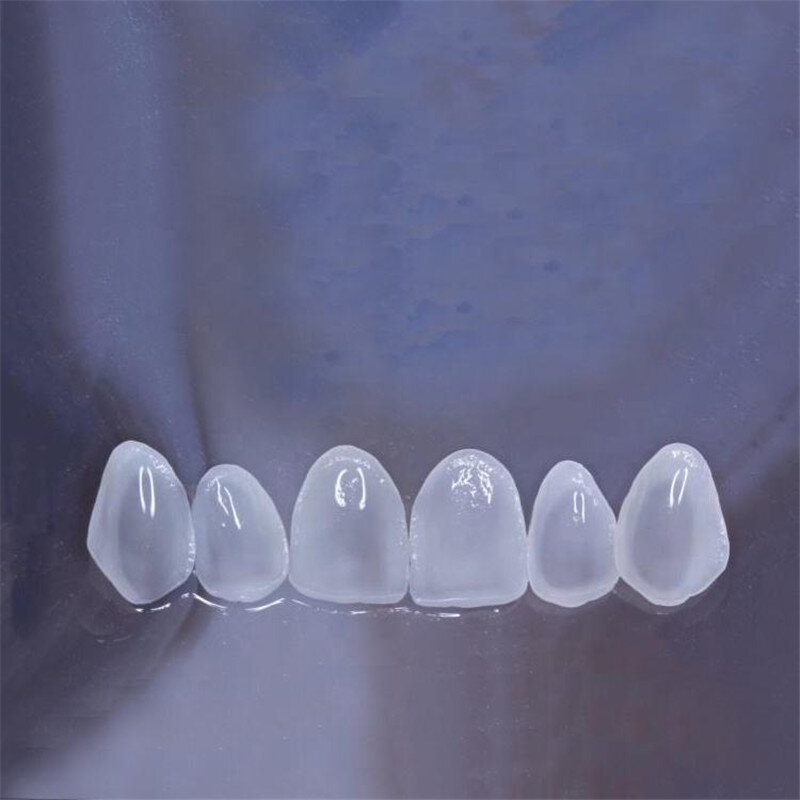 مادة خزفية سبيكة لمكبس الأسنان ، ليثيوم ديسيليكات ، 10