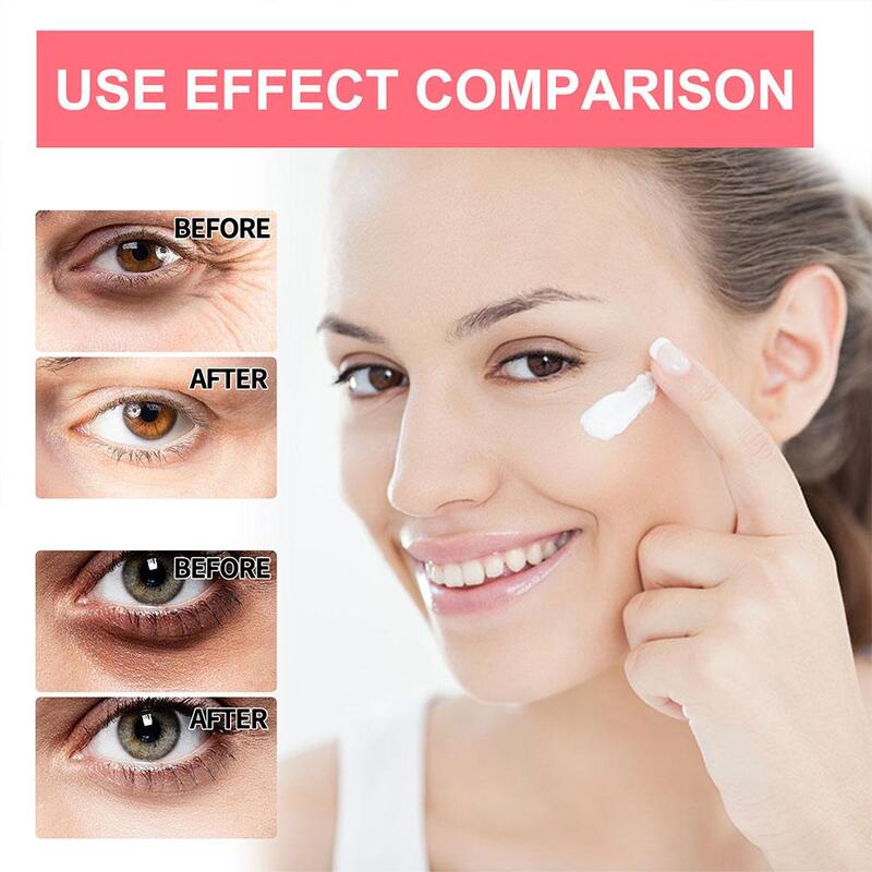 5PCs Anti-wrinkle Eye Cream Retinol Anti Puffiness Remove Dark Circles Eye Bags Stick Fade Fine Line Whitening Eye Skin Care