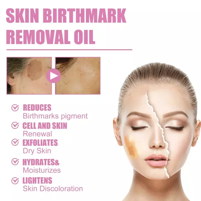 Pele e Birthmark Remoção Soro, Anti Freckle, Pigmentação desvanecer-se, Melasma Hidratante, Clareamento, Clarear Face Care, Essence Oil
