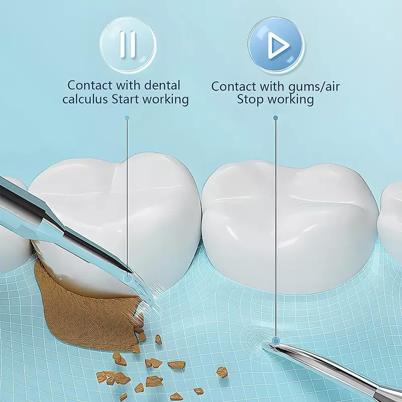 Descaler elettrico per denti ultrasuoni elettrico tartaro rimozione della placca rimozione della placca detergente per denti per uso domestico lucidatura dei denti delle macchie