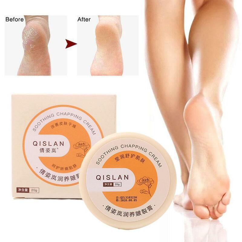 Crème réparatrice pour les pieds, 20g, soin des mains et des pieds, anti-sécheresse, fissure, talon, dissolvant de peau à fréquence
