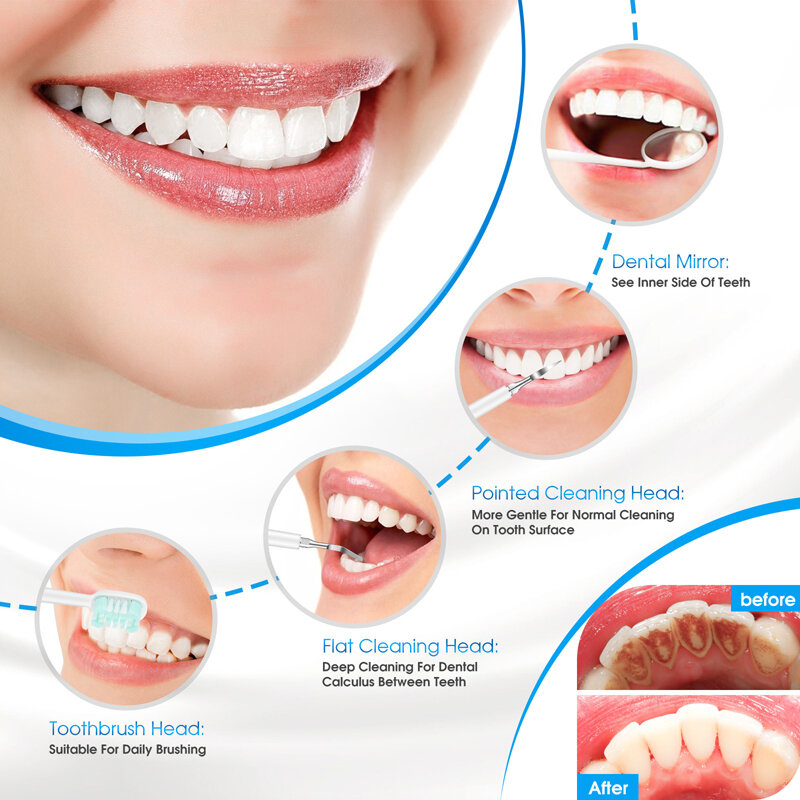 Cepillo de dientes eléctrico sónico para adultos, limpiador de dientes resistente al agua con carga inductiva, eliminador de cálculo Dental, eliminación de manchas de dientes, 5 modos