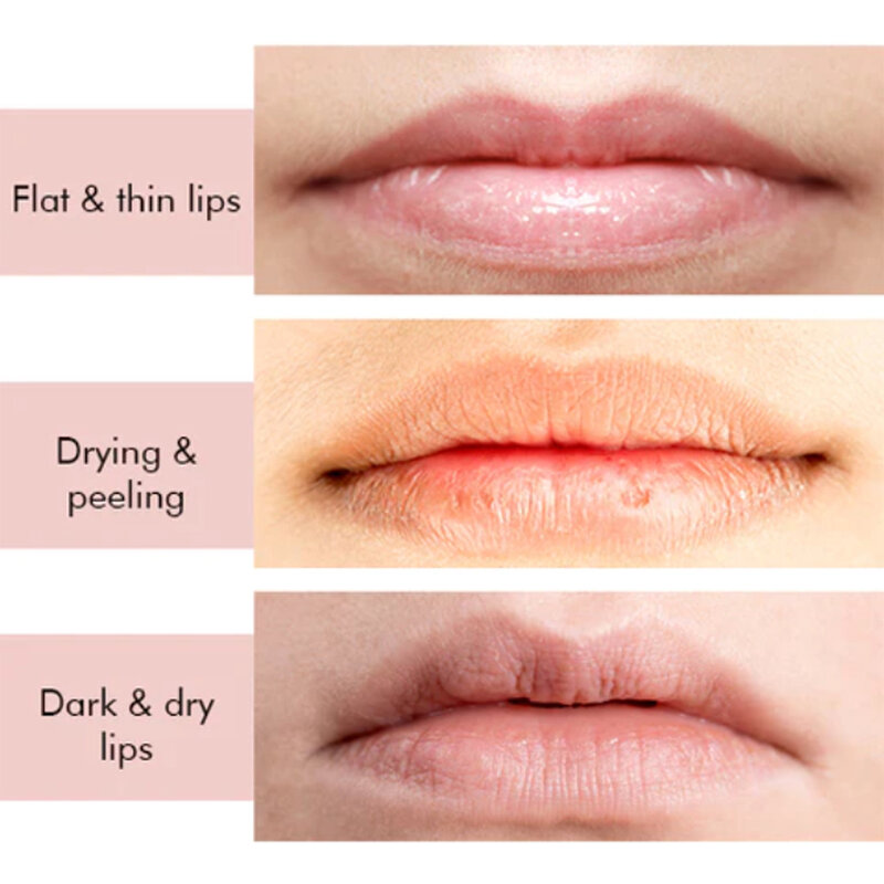 Suero regordeta para labios, hidratante de larga duración, Reduce las líneas secas, eliminación de Peelings, tratamiento agrietado, promueve el brillo, esencia para el cuidado de los labios