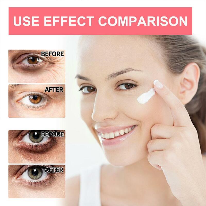 Crema de ojos antiarrugas con Retinol, antienvejecimiento para ojeras e hinchazón, Reduce las bolsas de los ojos y Wr X0S5